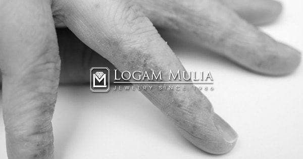 Tips Mengatasi Alergi Saat Mengenakan Perhiasan